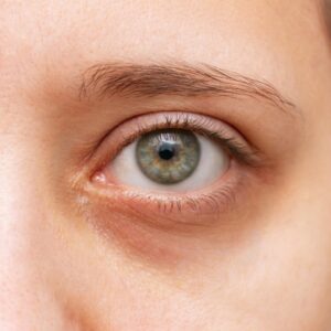 https://www.certifiedcosmetics.com/wp-content/uploads/2026/04/dark_circles-300x300.jpg
