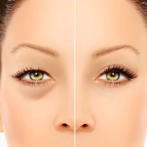 https://www.certifiedcosmetics.com/wp-content/uploads/2026/05/under-eye-puff-cosmetic-test-300x300.jpg
